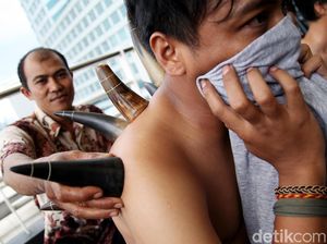 Video: Intip Keseruan Terapi Bekam Tanduk Sapi, Penasaran Mau Coba? Video: Intip Keseruan Terapi Bekam Tanduk Sapi, Penasaran Mau Coba?