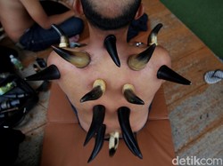 Manfaat Bekam Tanduk, Terapi Tradisional yang Lagi Ngetren