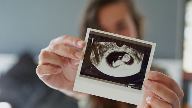 Perjuangan Ibu Hamil Anak Kedua Sambil Jalani Kemoterapi, Happy Ending!