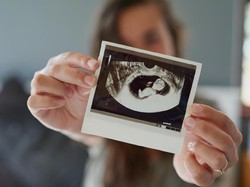 Perkembangan Janin di Minggu ke-1 sampai ke-4 Kehamilan