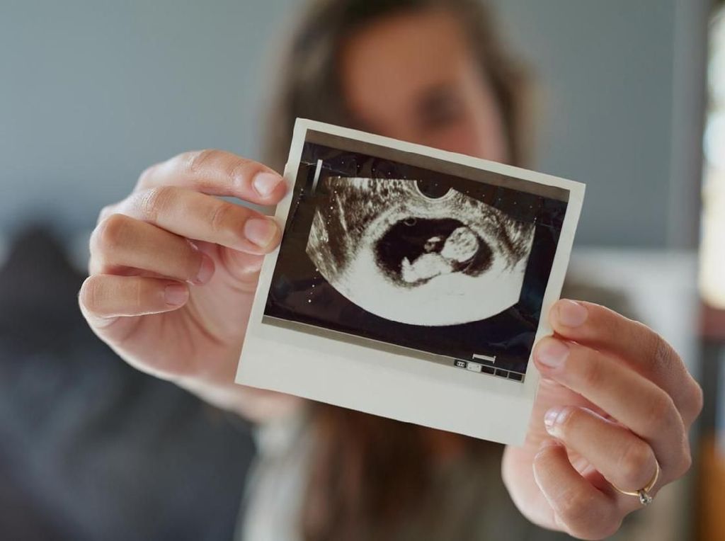 10 Tahun Mengidap Tumor Otak, Ibu Ini Beranikan Diri Punya Anak 10 Tahun Mengidap Tumor Otak, Ibu Ini Beranikan Diri Punya Anak
