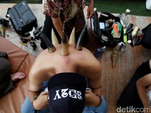 Bekam Tanduk Lagi Ngetren, Apa Bedanya dengan Bekam Konvensional? Bekam Tanduk Lagi Ngetren, Apa Bedanya dengan Bekam Konvensional?