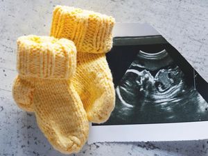 Perkembangan Janin di Minggu ke-5 Sampai ke-8 Kehamilan