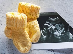 Perkembangan Janin di Minggu ke-5 Sampai ke-8 Kehamilan