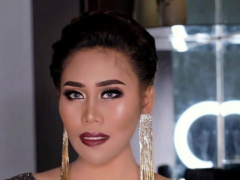 Cerita Evi Masamba Harus Operasi Usus Buntu Saat Hamil 5 Bulan