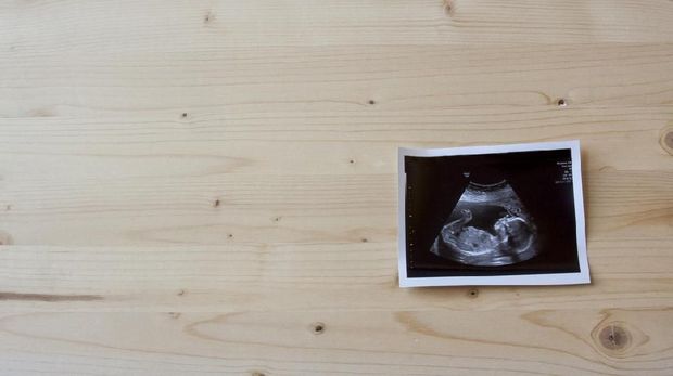 Ibu Sadar Hamil Saat Usia 6 Bulan, Alami Cryptic Pregnancy?