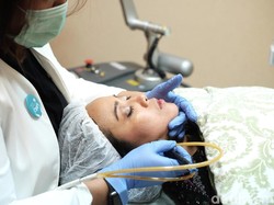 3 Laser Wajah Tanpa Bikin Ngelupas, Cocok Dilakukan Sebelum Acara Spesial