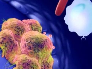 Video Kemenkes soal AI untuk Terapi Kanker: Bukan Menggantikan Diagnosis Video Kemenkes soal AI untuk Terapi Kanker: Bukan Menggantikan Diagnosis