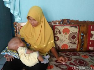 Tak Sanggup Berobat, Bayi Hidrosefalus di Purworejo Butuh Bantuan Tak Sanggup Berobat, Bayi Hidrosefalus di Purworejo Butuh Bantuan