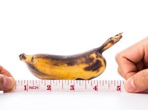 Horor! Penis Pria Menghitam dan Membusuk sampai Harus Diamputasi, Ini Sebabnya Horor! Penis Pria Menghitam dan Membusuk sampai Harus Diamputasi, Ini Sebabnya