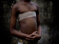 Menyetrika Payudara, Praktik dari Afrika yang Masih Terjadi di Inggris