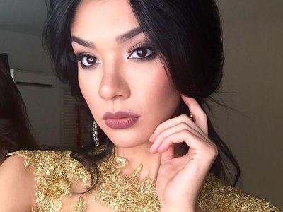 Potret Ratu Kecantikan yang Ngaku Jalani Operasi Plastik Sebelum Kompetisi