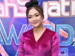 Tampil Seksi, Kaki Marion Jola Disoroti Netizen