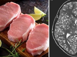 Makan Daging Babi Setengah Matang, Remaja di India Ini Kehilangan Nyawanya