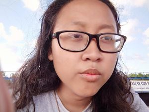 Ajeng Korban Penjambretan di Rasuna Said Menjalani Operasi