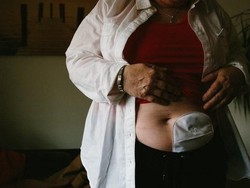 Implan Vagina Kontroversial Mungkin Bisa Ditawarkan Lagi di Inggris