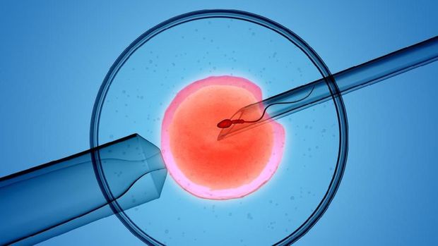 sperm injection