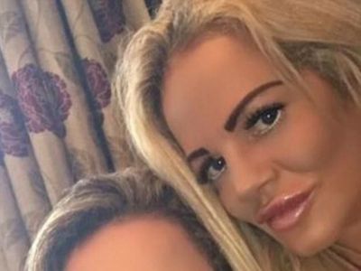 Foto: Demi Mirip Model Seksi, Ibu-Anak Habiskan Rp 1 M untuk Oplas