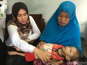Tubuh Balita di Mojokerto Kurus dan Kaku Mirip Boneka Menderita Gizi Buruk
