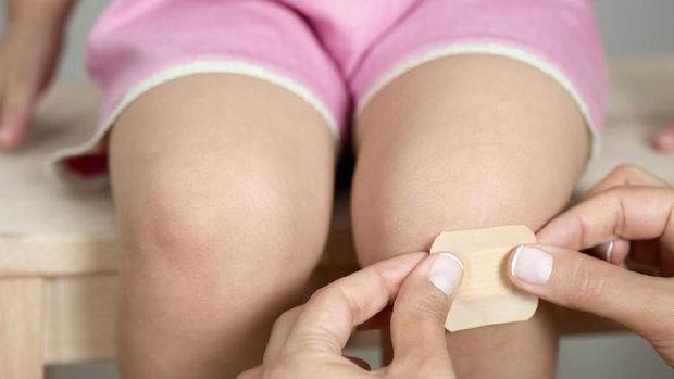 5 Trik Lepaskan Plester Anak Tanpa Rasa Sakit