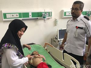 Tubuh Balita di Mojokerto Kaku Mirip Boneka karena Ada Kerusakan Otak