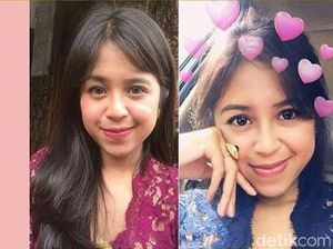 Mahasiswi Cantik di Bali Tewas karena Dicekik Pacar