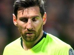 Terlihat luka berada di hidung dan kelopak mata kiri Messi. Akibatnya, Messi menjadi tak nyaman bermain menghadapi MU. (Foto: Michael Regan/Getty Images)