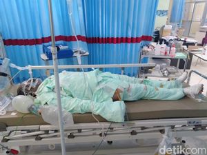 Polisi akan Periksa Kejiwaan Menantu yang Bakar Mertua