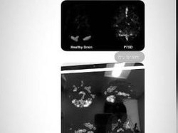 Ngeri, Ariana Grande Bagikan Scan Otaknya yang Idap Trauma