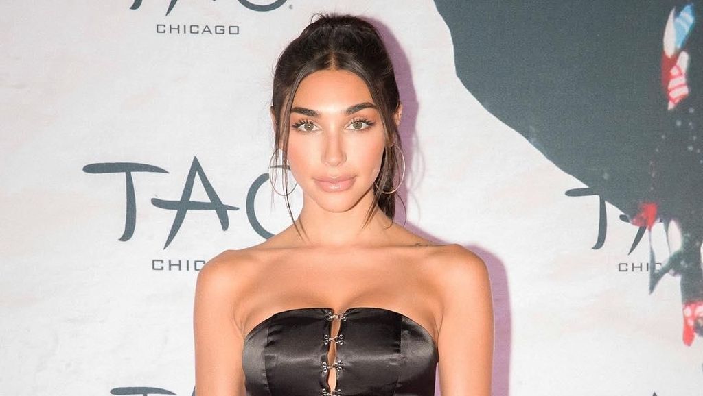 Ini Mantan Seksi Justin Bieber yang Kontroversial, Dipenjara Hingga Oplas Ini Mantan Seksi Justin Bieber yang Kontroversial, Dipenjara Hingga Oplas