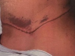 Jerat Leher Pengungsi Afghanistan dengan Tali Sepatu, Dihukum 11 Tahun Penjara