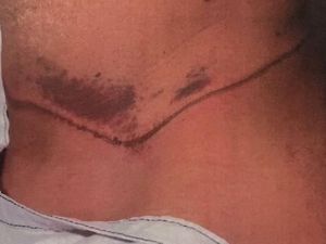 Jerat Leher Pengungsi Afghanistan dengan Tali Sepatu, Dihukum 11 Tahun Penjara Jerat Leher Pengungsi Afghanistan dengan Tali Sepatu, Dihukum 11 Tahun Penjara