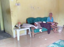 Jari Tangan Penderita Gangguan Jiwa Ini Habis Karena Dimakan Sendiri