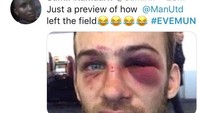 Netizens menggambarkan wajah Man United seperti ini sepulang dari lawatan ke markas Everton. Babak belur. (Foto: dok.Istimewa)
