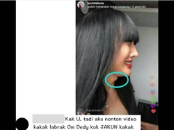 Lucinta Luna Disebut Punya Jakun, Apa Sih Itu?