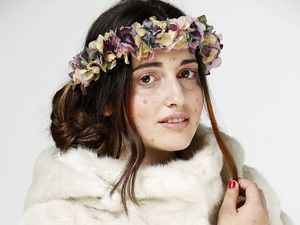 Potret Model yang Disebut Alien Hingga Monster karena Punya 500 Tanda Lahir