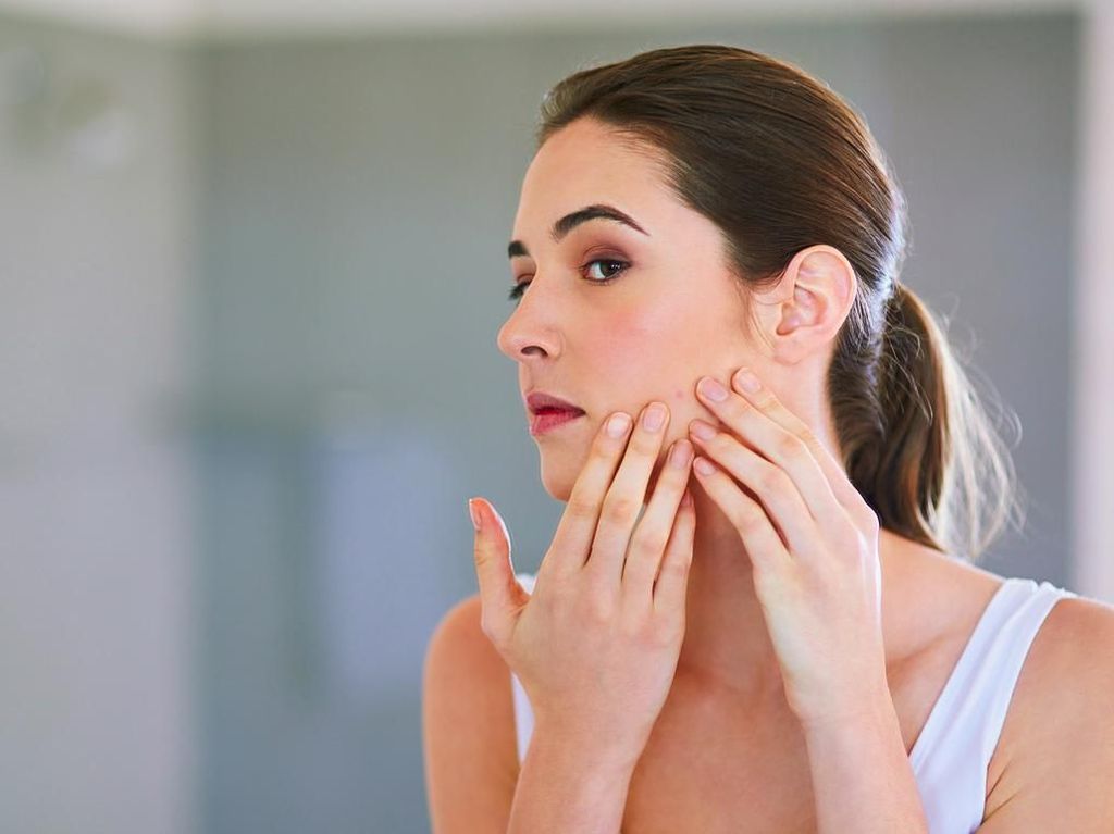 6 Kandungan Skincare yang Bisa Menghilangkan Jerawat
