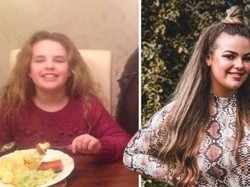 Selama 14 Tahun, Gadis Ini Takut Dengar Suara Makanan Dikunyah!