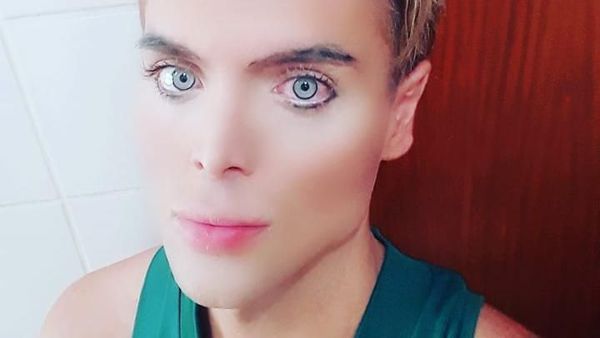 Seperti Ini Penampilan Pria yang Habiskan Rp 14 M Demi Mirip Pacar Barbie