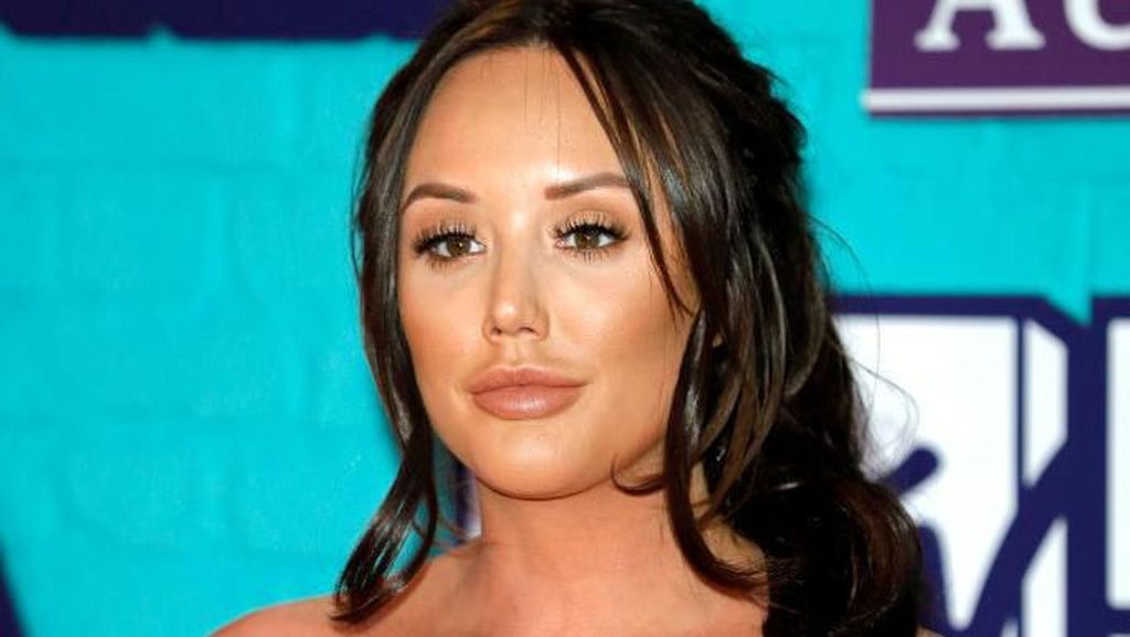 Foto: Penampilan Before After Bintang Reality TV yang Kebanyakan Botox