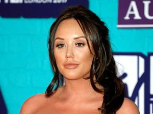 Foto: Penampilan Before After Bintang Reality TV yang Kebanyakan Botox