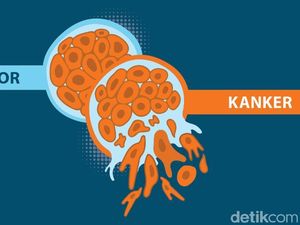 Tumor Vs Kanker, Bedanya Apa Sih? Tumor Vs Kanker, Bedanya Apa Sih?