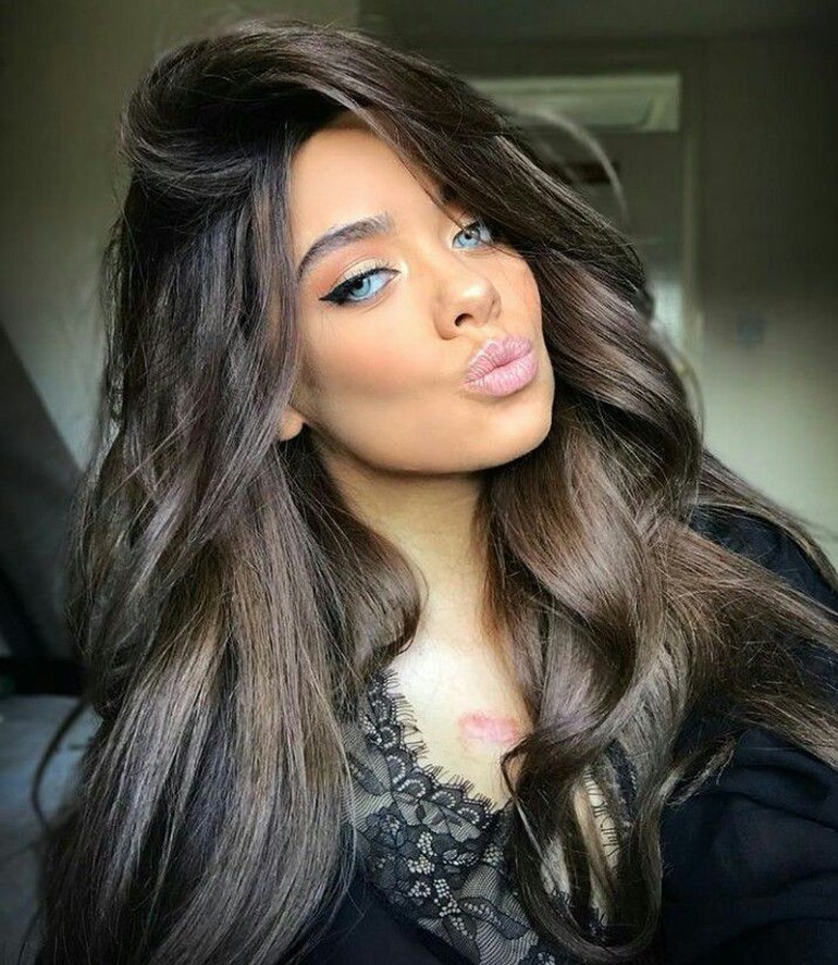 Ia mendatangi klinik kecantikan yang diketahuinya lewat Instagram. Cassidy yang mengaku tidak pernah melakukan suntik filler mengaku tertarik karena sudah banyak orang melakukan filler bibir dengan hasil yang baik tanpa efek buruk. Sayangnya hasil yang diharapkan tidak terjadi pada bibirnya. Setelah filler, bibirnya menjadi bengkak yang tidak wajar dan membiru.  Foto: Dok. Instagram