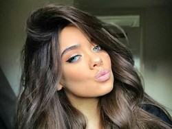 Gara-gara Filler, Selebgram Cantik Ini Nyaris Kehilangan Bibir