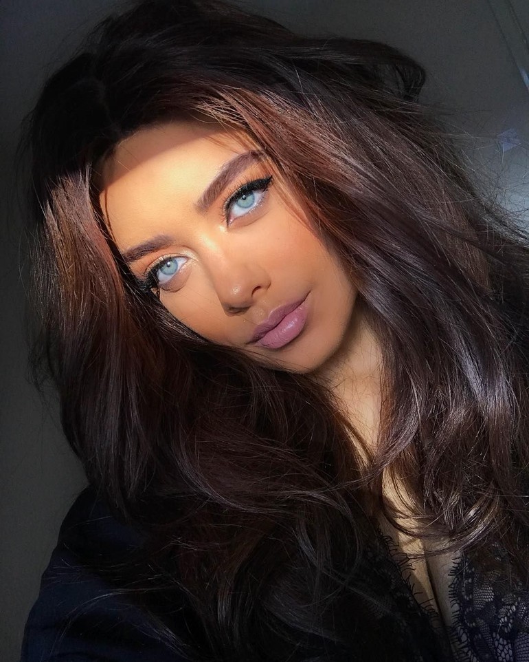 Untungnya kini bibir Cassidy sudah kembali normal setelah ia mencari klinik kecantikan lainnya yang lebih terpercaya untuk menangani kerusakan bibirnya. Pengalaman buruknya ini dibagi di Instagramnya dengan imbauan kepada wanita muda agar jangan tergoda melakukan filler yang ditawarkan di Instagram.  Foto: dok. Instagram @cassidyvalentine