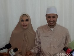 Perjuangan Berat hingga Sembuh dari Cacar Buat Kartika Putri Menangis