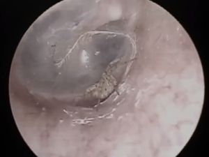 Telinga Terasa Gatal, Ternyata Ada Laba-laba Lagi Bikin Sarang