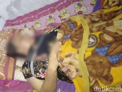 Ibu dan Anak di Pasuruan Bunuh Diri Minum Racun Ikan