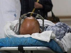 Ilmuwan China Uji Implan Otak untuk Sembuhkan Kecanduan Narkoba