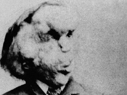 Menjadi Misteri Selama 130 Tahun, Lokasi Kuburan Manusia Gajah Ditemukan